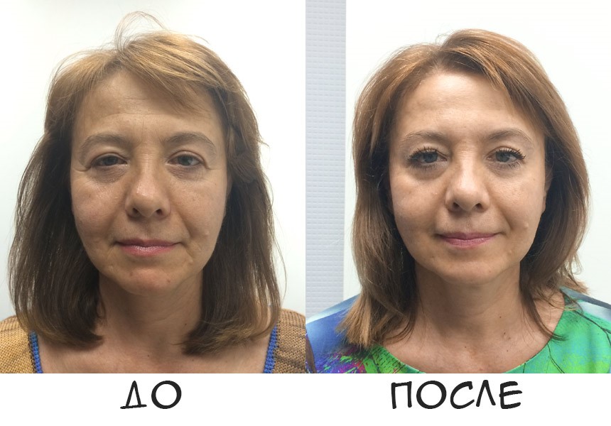 Masaje medicale pentru corp: ce tipuri sunt și principalele lor caracteristici