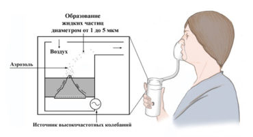 Reguli pentru utilizarea unui inhalator: cum funcționează și de ce?